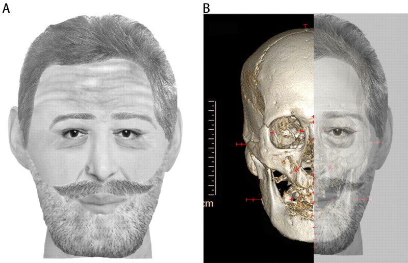 digital reconstruction 王の頭蓋骨は偽物？衝撃的な論文発表！