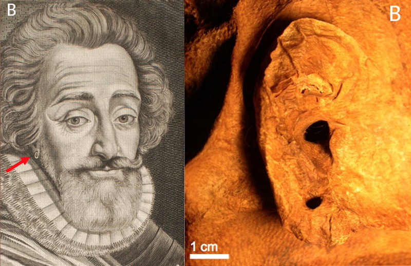 pierced earlobe 王の頭蓋骨は偽物？衝撃的な論文発表！