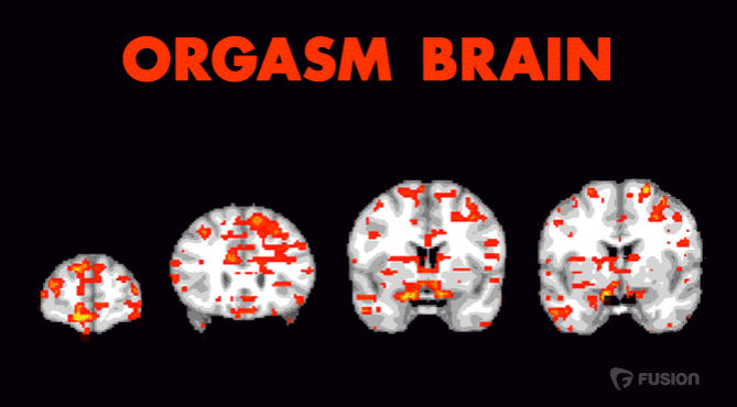 Orgasm brain chemical Naked Girls 18+ 2023