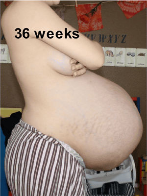 三つ子を妊娠している妊婦のおなかの7週目から出産までの写真 Gigazine