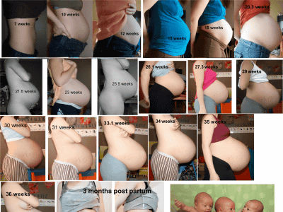 妊婦はキメラ化する など 妊娠によって女性が経験する18個の変化 Gigazine