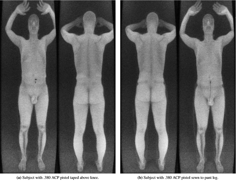 パンツの中まで見えてしまう空港の全身透視スキャナーは武器を持った