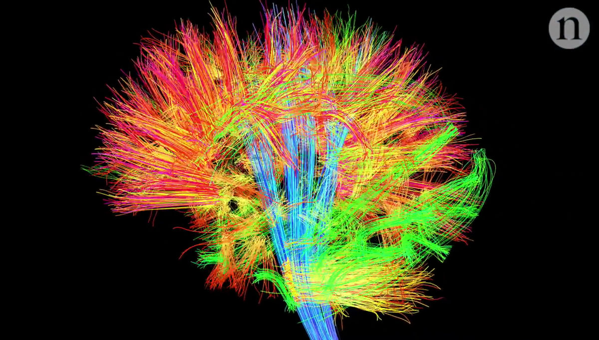 新しい脳地図作成によって人間の脳の部位や特徴をこれまでより正確に分析できる可能性 Gigazine