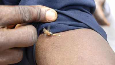 ミツバチの針を体に刺す健康法 でミツバチに刺された女性が死亡してしまう Gigazine