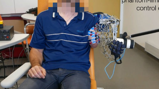 手足を失った人が 幻肢 を利用して手術なしで動かせるロボットアームが開発される Gigazine