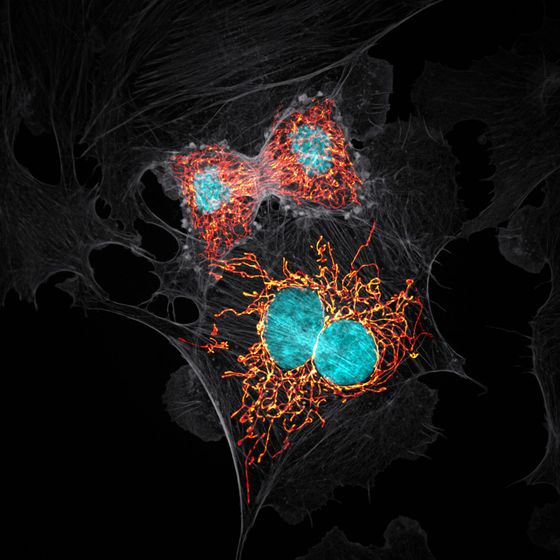 幻想的で美しいミクロの世界を顕微鏡で捉えた「Nikon's Small World