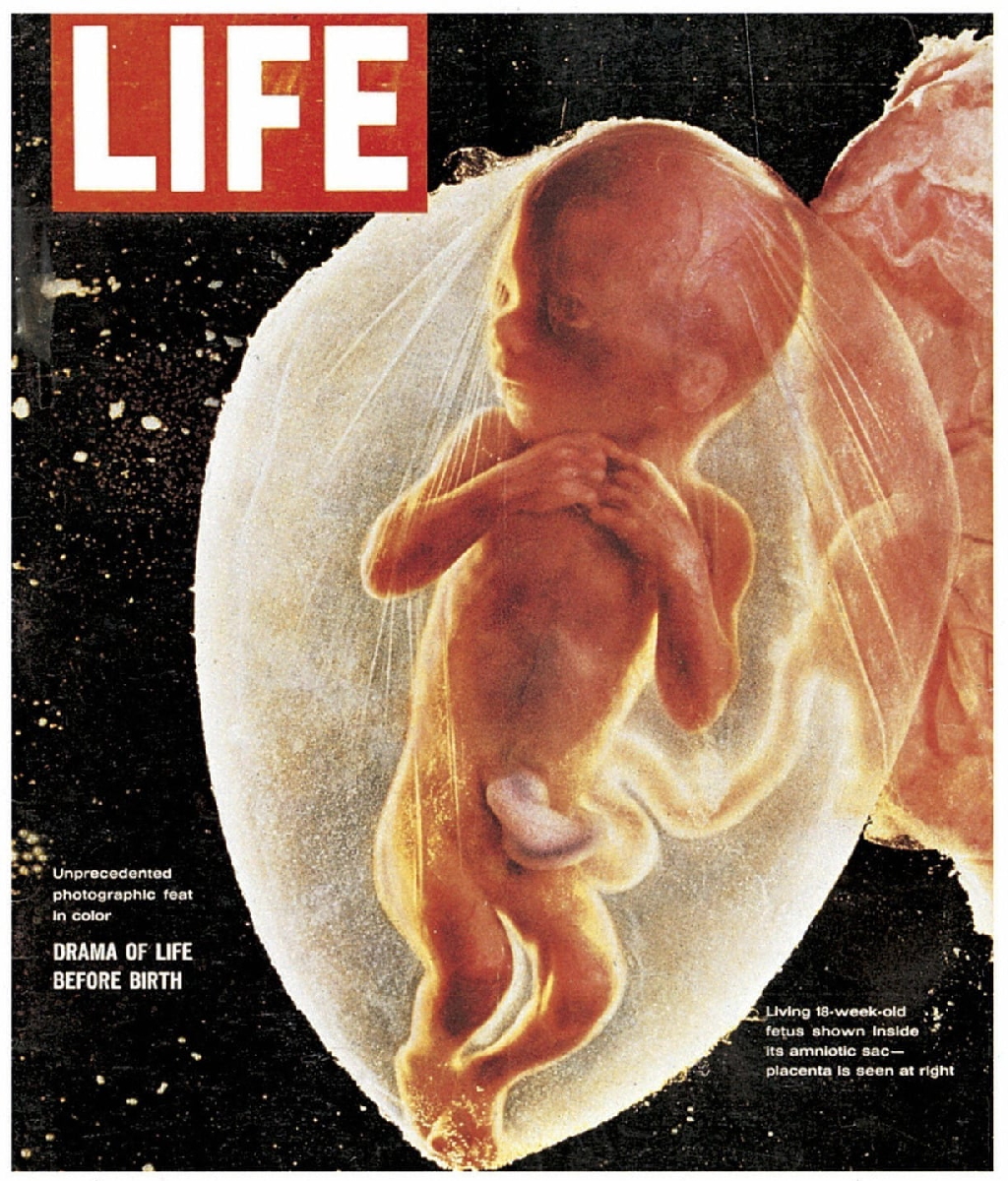 受精後約18週目の胎児を鮮明に写した作品 Foetus 18 Weeks はどのようにして撮影されたのか Gigazine