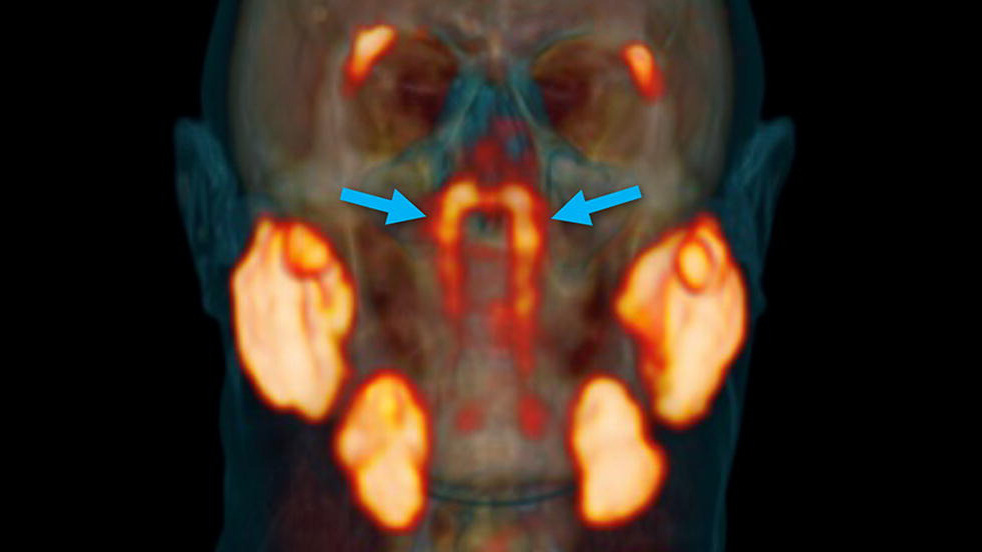 未知の臓器 が人間の喉の奥から発見される Gigazine