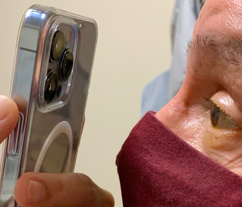 Iphone 13 Pro Max のマクロ撮影性能は眼科医が診察に使うレベルに達している Gigazine