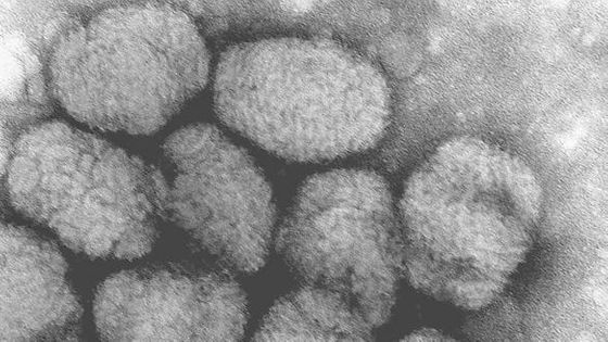 40年前に根絶された「天然痘」のラベルが貼られた小瓶が研究所の冷凍庫