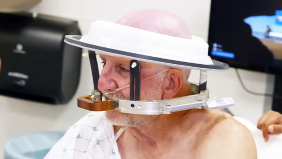 湿性AMDはどれくらいの速さで進行しますか?